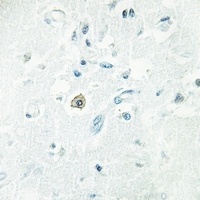 Anti-DOK7 Antibody