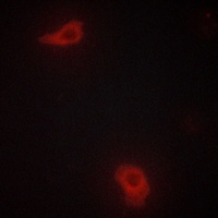 Anti-DOK7 Antibody