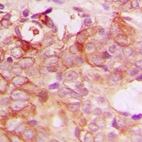 Anti-PIG3 Antibody