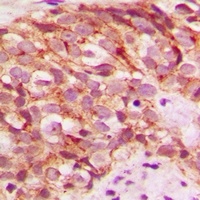 Anti-Glycerate Kinase Antibody