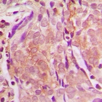 ZNF397 Antibody