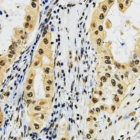 Anti-LMO3 Antibody