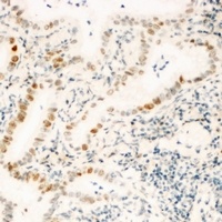 ZNF596 antibody