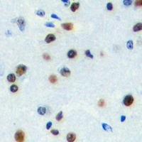 Anti-ZNF785 Antibody