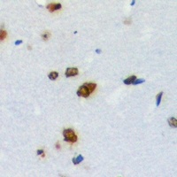 Anti-ZNF668 Antibody