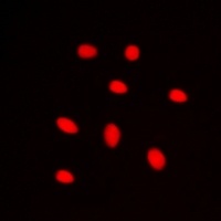Anti-ZNF668 Antibody