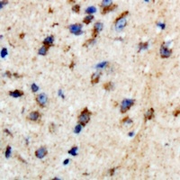 Anti-BTBD6 Antibody