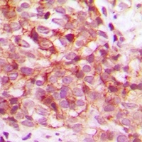 Anti-CDK15 Antibody