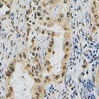 ZNF436 Antibody