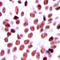 Anti-BCA3 Antibody