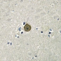 Anti-SERINC1 Antibody