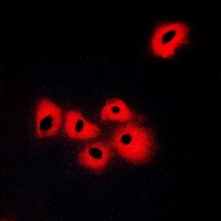 Anti-SERINC1 Antibody