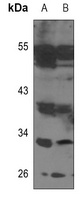 TCFL5 Antibody