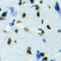 TCFL5 Antibody