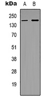 SUR2 Rabbit Polyclonal Antibody