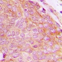 Anti-CHKB Antibody