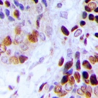 Anti-Adenylate Kinase 6 Antibody