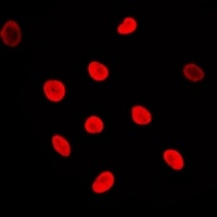 Anti-Adenylate Kinase 6 Antibody