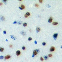 Anti-DYRK1B Antibody