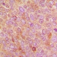 Anti-Cytochrome P450 24A1 Antibody