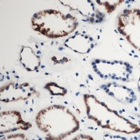 ARRDC2 antibody