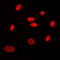 CABLES2 antibody