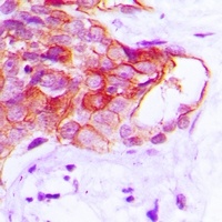 Anti-CADM2 Antibody