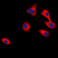 Anti-CADM2 Antibody