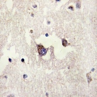 Anti-CADM3 Antibody