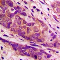 Cytochrome P450 7B1 Rabbit Polyclonal Antibody