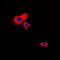 Anti-HSPB2 Antibody