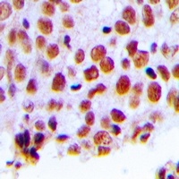 Anti-MSH2 Antibody