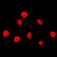 Anti-MSH2 Antibody