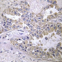 Anti-Laminin beta 2 Antibody
