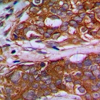 Anti-MRPL22 Antibody