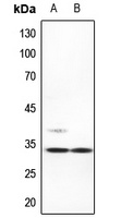 ACBD6 Antibody