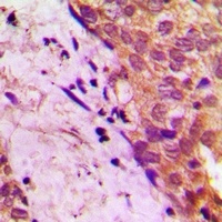 Anti-APBB2 Antibody