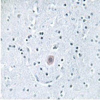 Anti-Arylsulfatase I Antibody