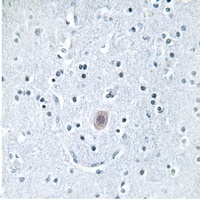 ARSI antibody