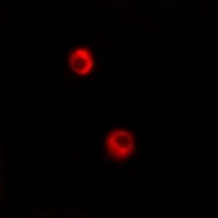 Anti-Arylsulfatase I Antibody