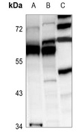 DDX19B Rabbit Polyclonal Antibody