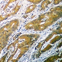 B4GALT1 antibody