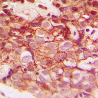 Anti-CLIP3 Antibody