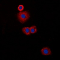 Anti-CLIP3 Antibody