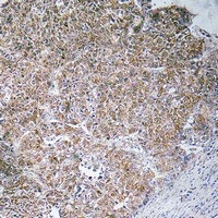 Anti-CHST13 Antibody