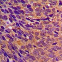 CBR3 antibody