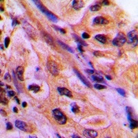 Anti-CDC42EP4 Antibody