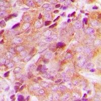 Anti-CEP76 Antibody