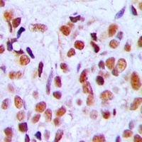 Anti-RRP8 Antibody