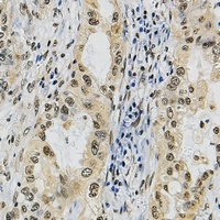 Anti-POLR3A Antibody